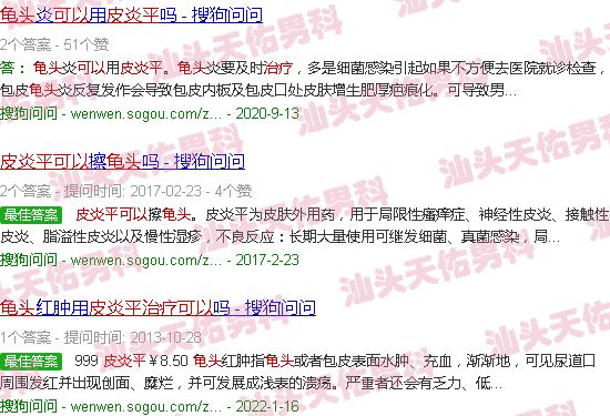 汕頭皮炎平可以治療龜頭炎癥嗎