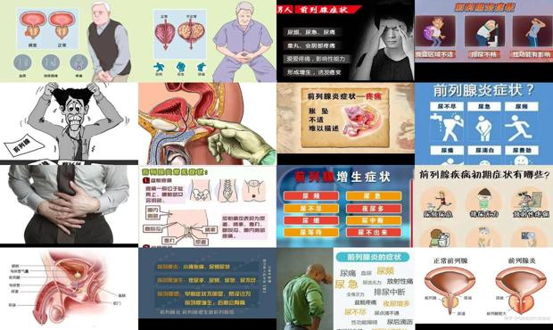 汕頭前列腺發(fā)炎癥狀