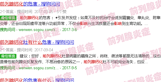 汕頭前列腺鈣化有什么影響