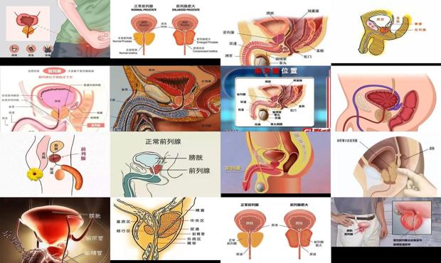 汕頭前列腺位置