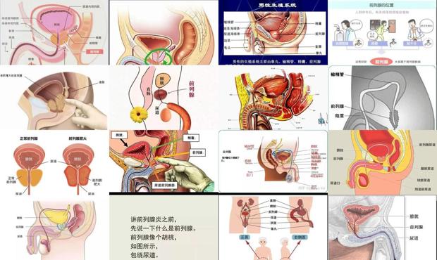 汕頭前列腺在哪里