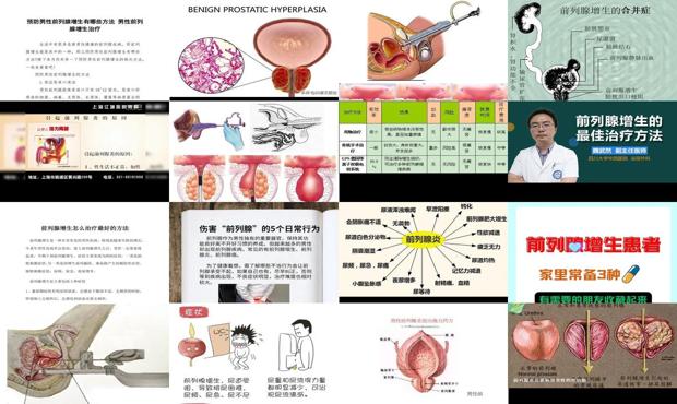 汕頭前列腺增生的治療方法