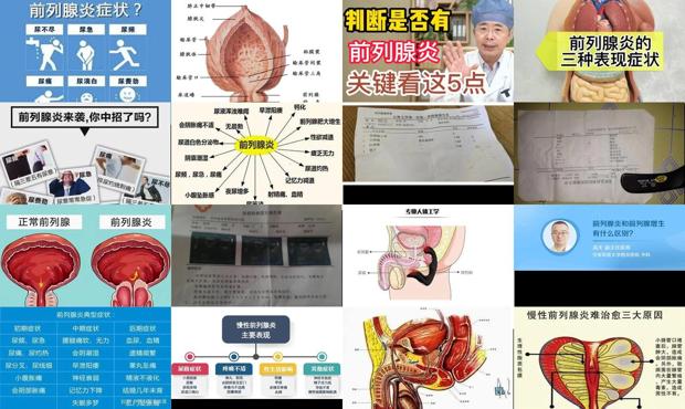 汕頭前淚腺炎癥狀