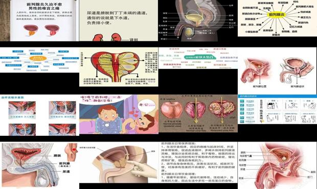 汕頭前列腺炎的由來(lái)