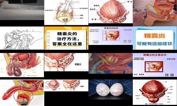 汕頭精襄炎癥狀